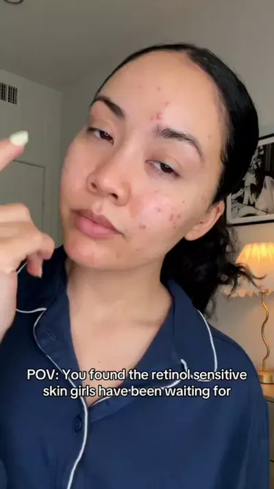 Retinol 1.0 Cream for Fine Lines & Wrinkles | Obagi
