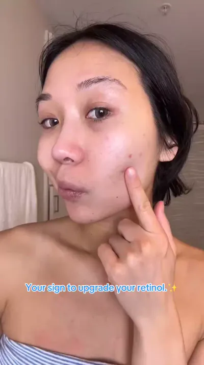 Retinol 1.0 Cream for Fine Lines & Wrinkles | Obagi